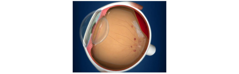 Read more about the article Macular of Retina